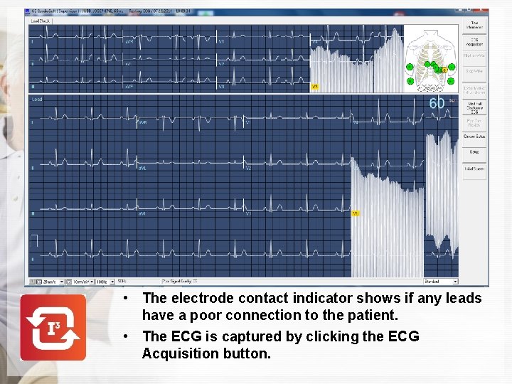  • The electrode contact indicator shows if any leads have a poor connection