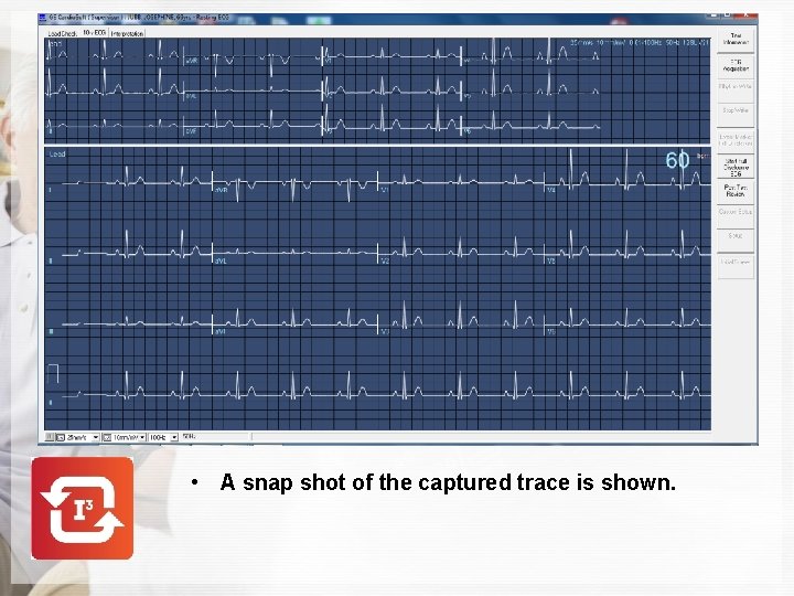  • A snap shot of the captured trace is shown. 