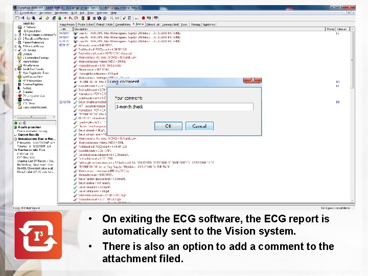  • On exiting the ECG software, the ECG report is automatically sent to