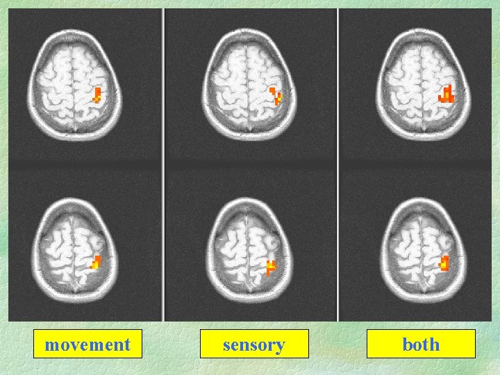 movement sensory both 