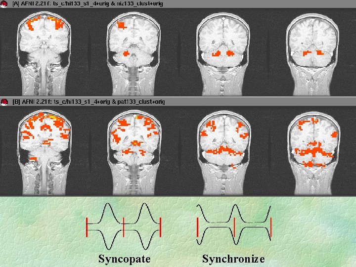 Syncopate Synchronize 