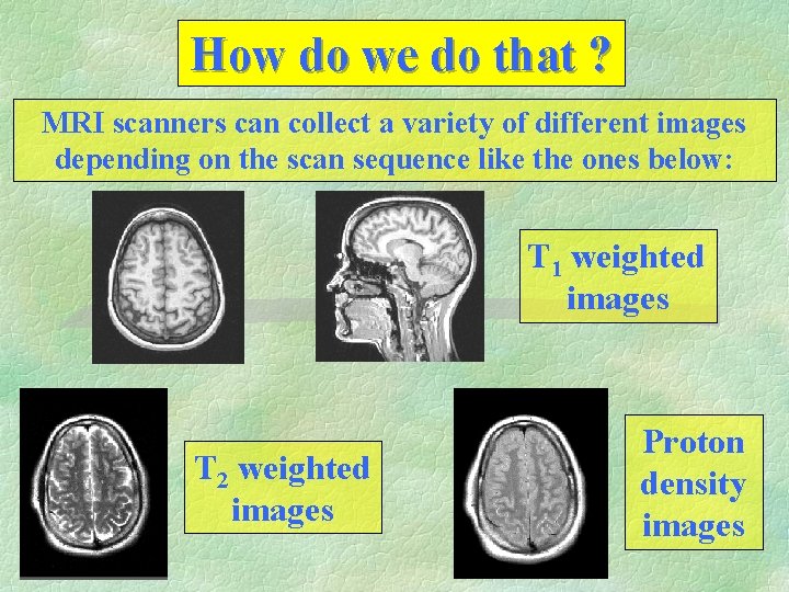 How do we do that ? MRI scanners can collect a variety of different