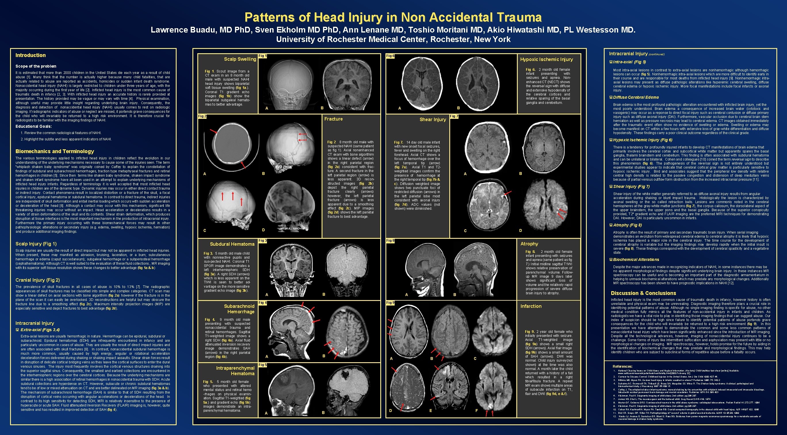 Patterns of Head Injury in Non Accidental Trauma Lawrence Buadu, MD Ph. D, Sven