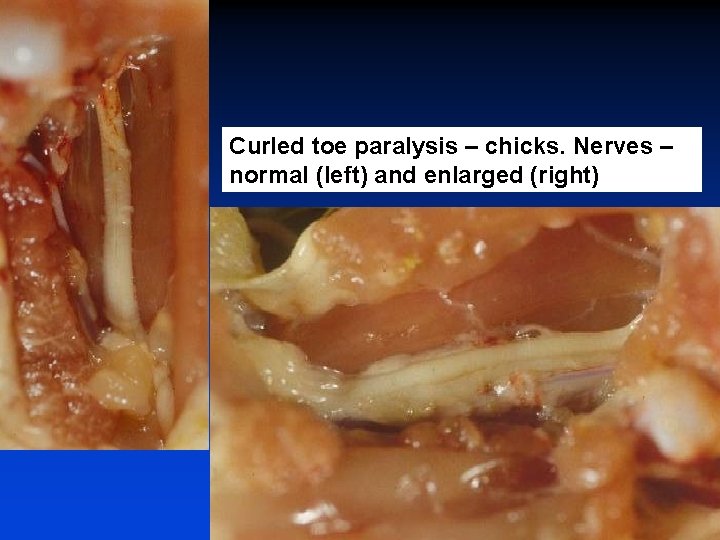 Curled toe paralysis – chicks. Nerves – normal (left) and enlarged (right) 
