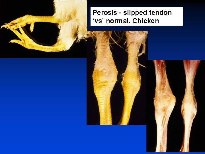 Perosis - slipped tendon ‘vs’ normal. Chicken 