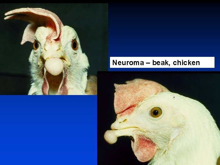 Neuroma – beak, chicken 