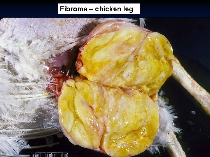 Fibroma – chicken leg 