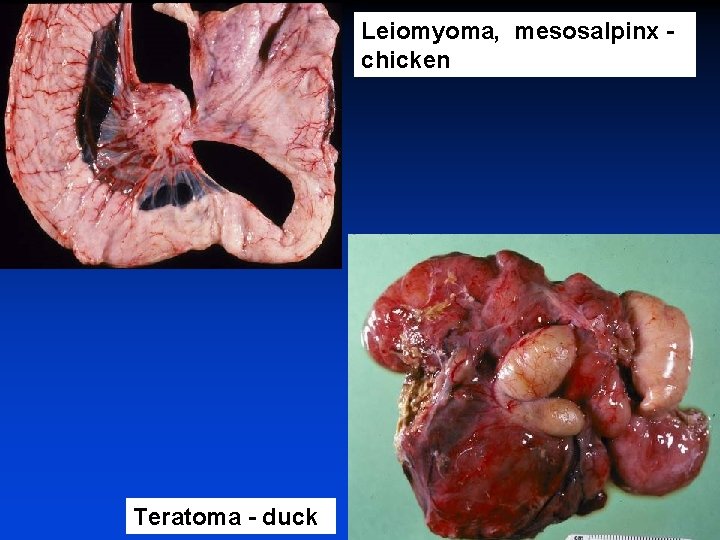 Leiomyoma, mesosalpinx chicken Teratoma - duck 