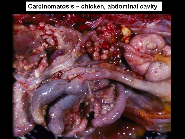 Carcinomatosis – chicken, abdominal cavity 