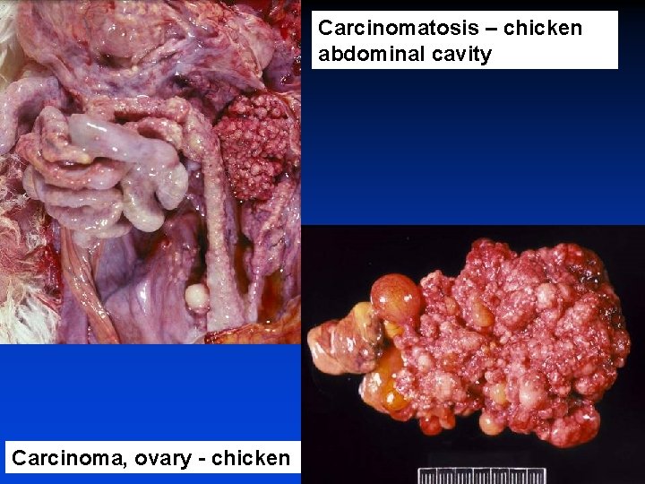 Carcinomatosis – chicken abdominal cavity Carcinoma, ovary - chicken 