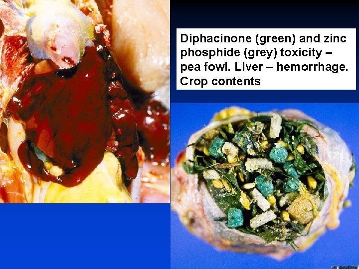 Diphacinone (green) and zinc phosphide (grey) toxicity – pea fowl. Liver – hemorrhage. Crop