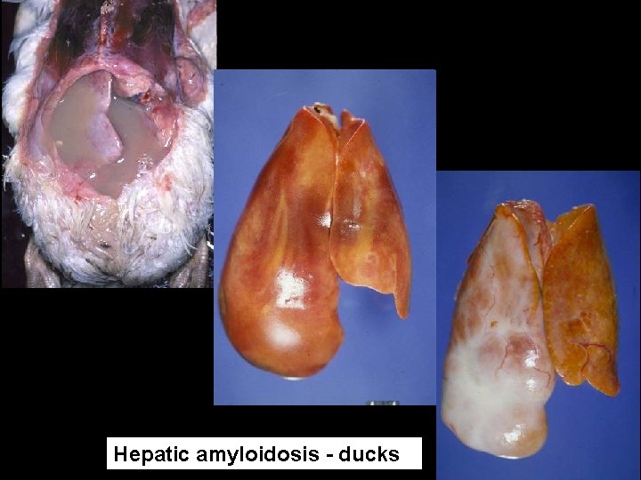 Amyloidosis, ‘water belly’ in ducks Hepatic amyloidosis - ducks 