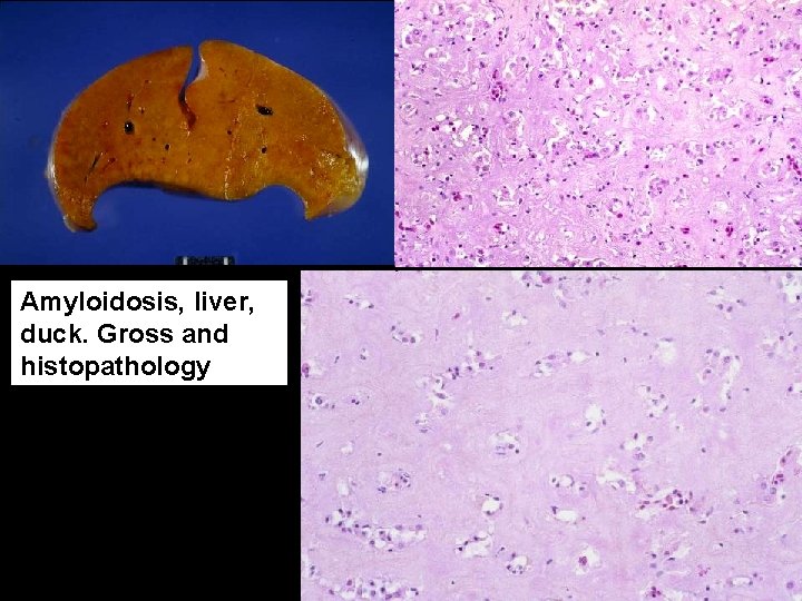 Amyloidosis, liver, duck. Gross and histopathology 