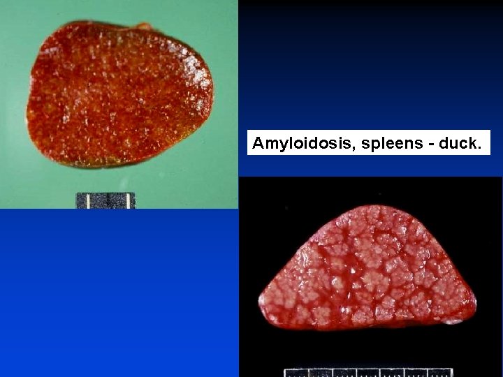 Amyloidosis, spleens - duck. 