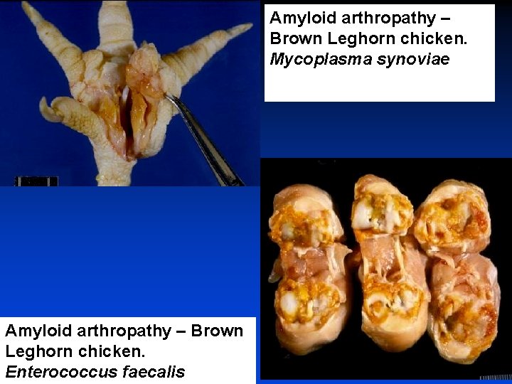 Amyloid arthropathy – Brown Leghorn chicken. Mycoplasma synoviae Amyloid arthropathy – Brown Leghorn chicken.