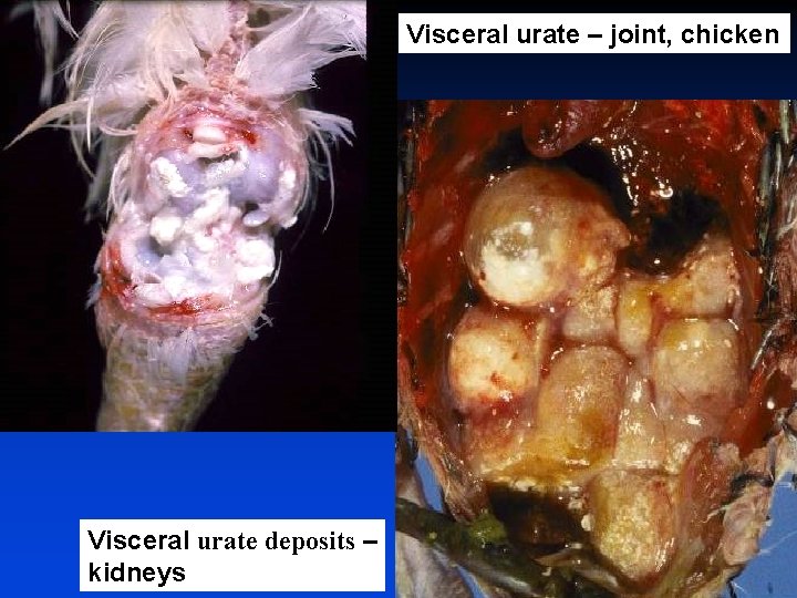 Visceral urate – joint, chicken Visceral urate deposits – kidneys 
