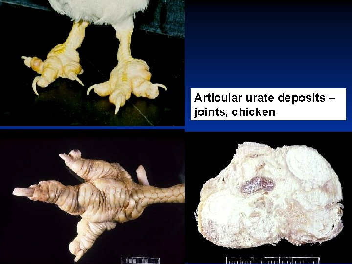 Articular urate deposits – joints, chicken 