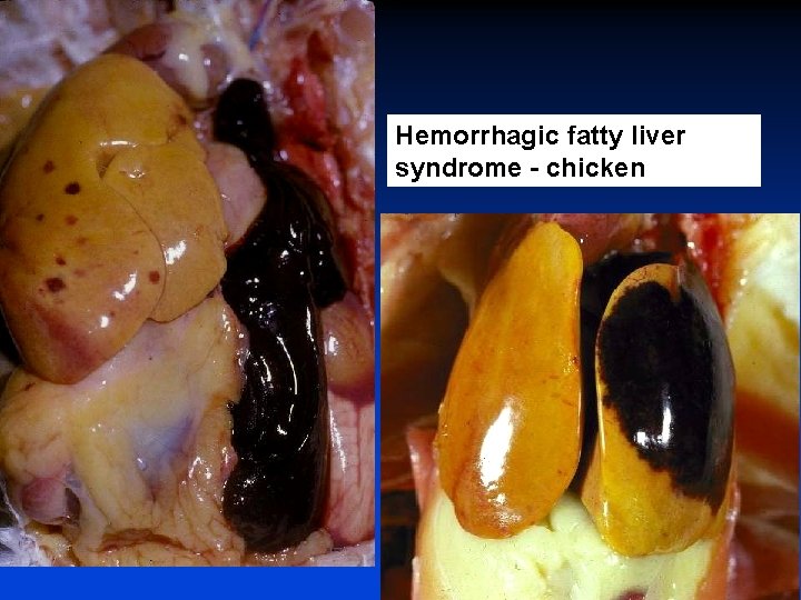 Hemorrhagic fatty liver syndrome - chicken 