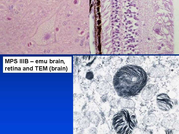 MPS IIIB – emu brain, retina and TEM (brain) 