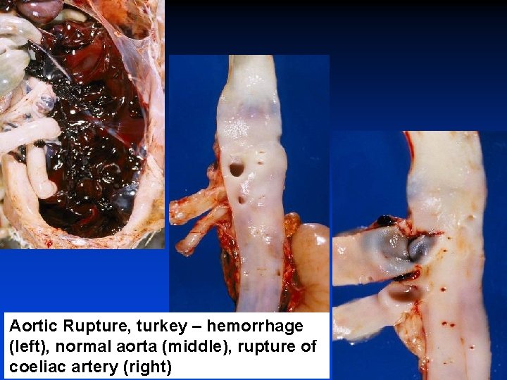 Aortic Rupture, turkey – hemorrhage (left), normal aorta (middle), rupture of coeliac artery (right)