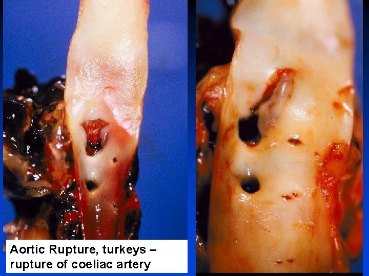 Aortic Rupture, turkeys – rupture of coeliac artery 