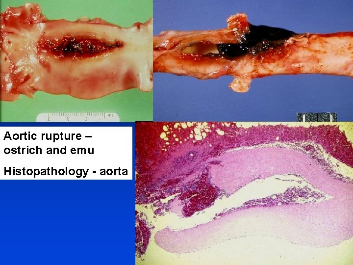 Aortic rupture – ostrich and emu Histopathology - aorta 