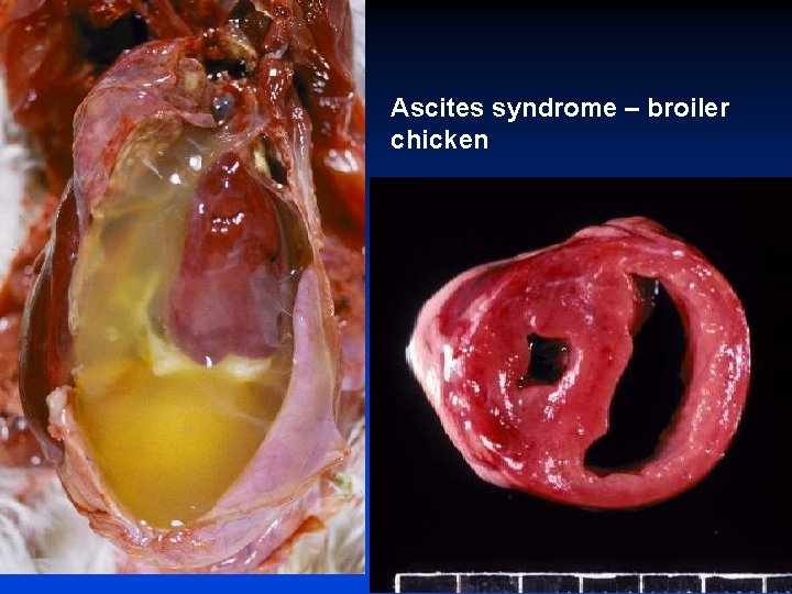 Ascites syndrome – broiler chicken 