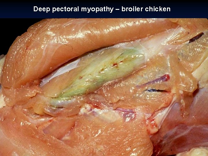 Deep pectoral myopathy – broiler chicken 
