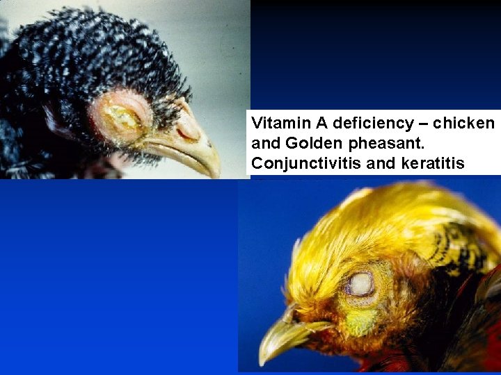 Vitamin A deficiency – chicken and Golden pheasant. Conjunctivitis and keratitis 