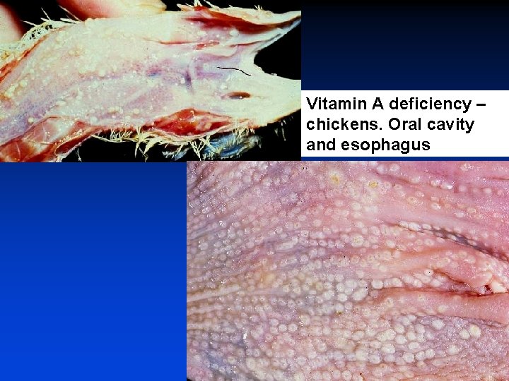 Vitamin A deficiency – chickens. Oral cavity and esophagus 