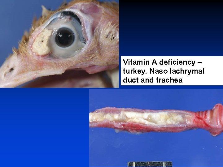 Vitamin A deficiency – turkey. Naso lachrymal duct and trachea 