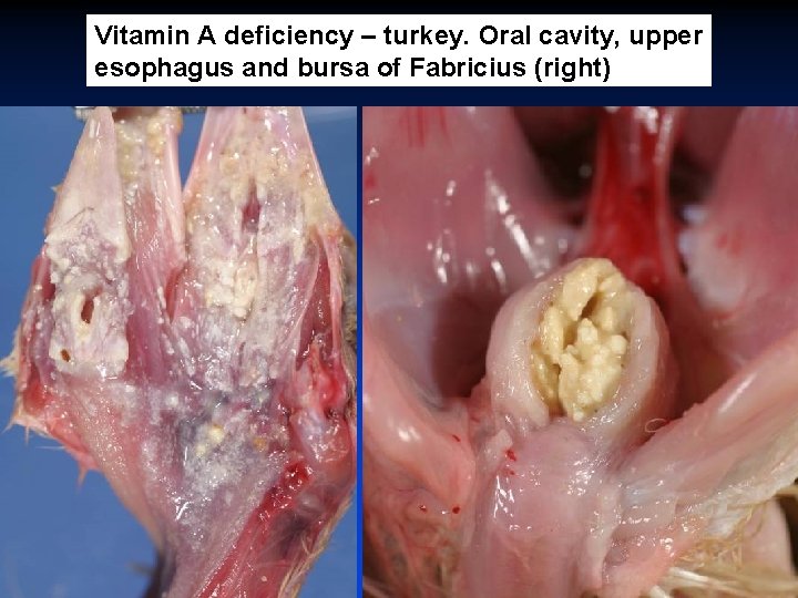 Vitamin A deficiency – turkey. Oral cavity, upper esophagus and bursa of Fabricius (right)