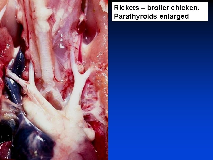 Rickets – broiler chicken. Parathyroids enlarged 