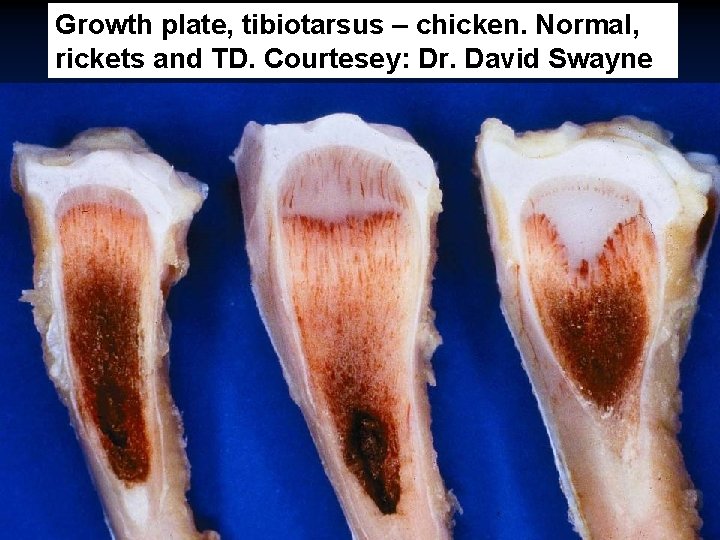 Growth plate, tibiotarsus – chicken. Normal, rickets and TD. Courtesey: Dr. David Swayne 