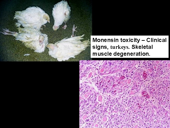 Ionophore toxicity (monensin) - turkeys Monensin toxicity – Clinical signs, turkeys. Skeletal muscle degeneration.