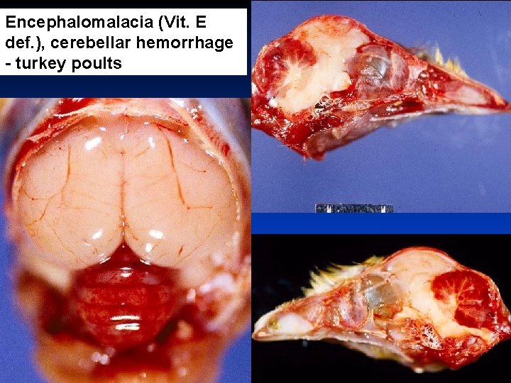 Encephalomalacia (Vit. E def. ), cerebellar hemorrhage - turkey poults 