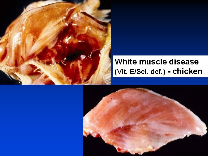 White muscle disease (Vit. E/Sel. def. ) - chicken 