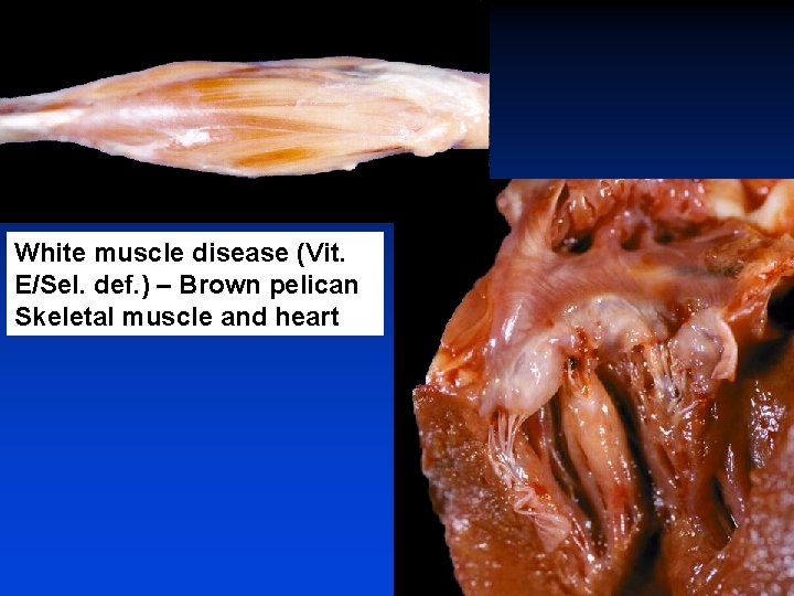 White muscle disease (Vit. E/Sel. def. ) – Brown pelican Skeletal muscle and heart