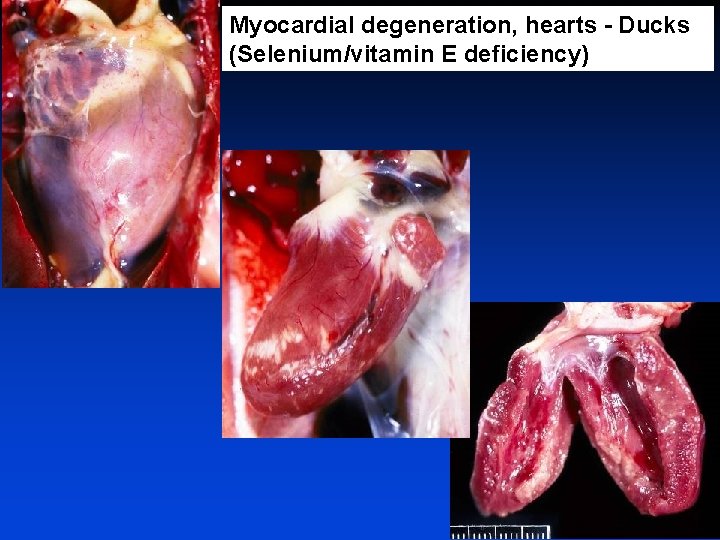 Myocardial degeneration, hearts - Ducks (Selenium/vitamin E deficiency) 