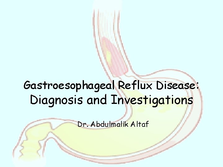 Gastroesophageal Reflux Disease: Diagnosis and Investigations Dr. Abdulmalik Altaf 