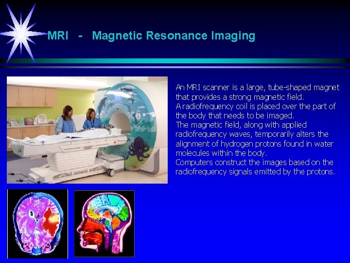 MRI - Magnetic Resonance Imaging An MRI scanner is a large, tube-shaped magnet that