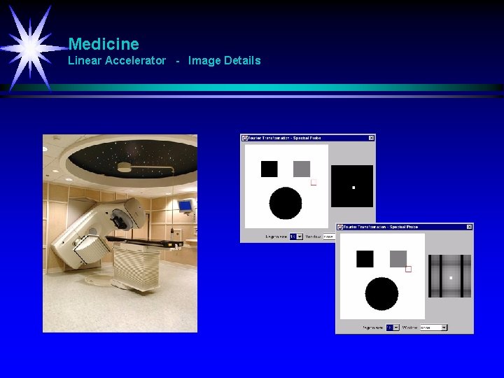 Medicine Linear Accelerator - Image Details 