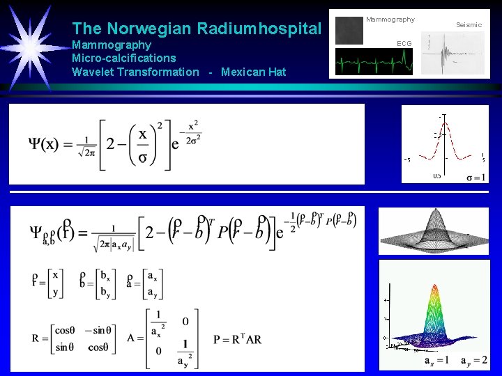 The Norwegian Radiumhospital Mammography Micro-calcifications Wavelet Transformation - Mexican Hat Mammography ECG Seismic 