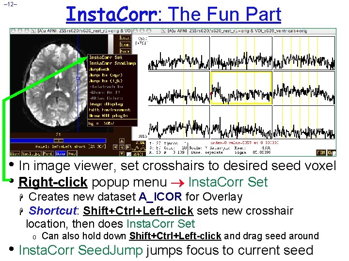 Insta. Corr: The Fun Part – 12– • In image viewer, set crosshairs to