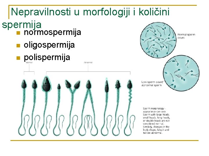 Nepravilnosti u morfologiji i količini spermija n normospermija oligospermija polispermija 
