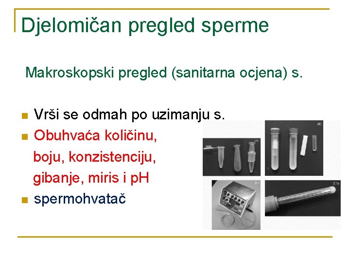 Djelomičan pregled sperme Makroskopski pregled (sanitarna ocjena) s. n n n Vrši se odmah