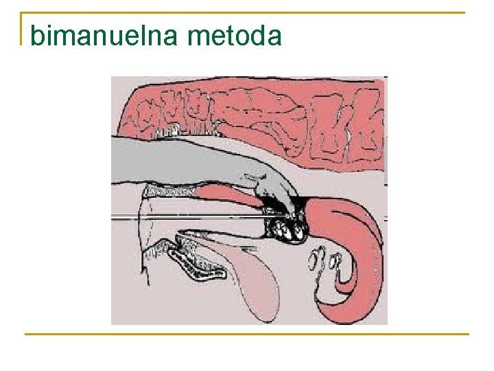 bimanuelna metoda 