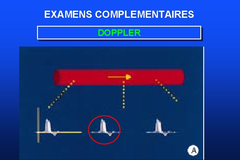 EXAMENS COMPLEMENTAIRES DOPPLER 