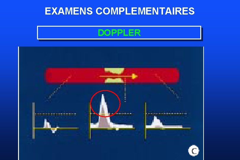 EXAMENS COMPLEMENTAIRES DOPPLER 