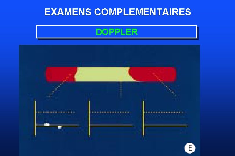 EXAMENS COMPLEMENTAIRES DOPPLER 